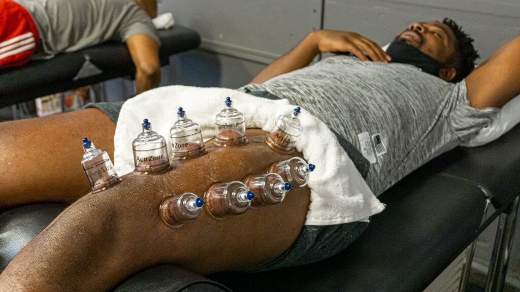 Cupping Therapy at Move
